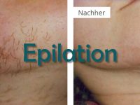 Einzel Haar Entfernung (Epilation)